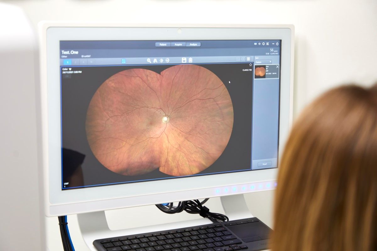 Best Practice Eyecare Golden Beach Ophthalmologist Sunshine Coast eye exam 18